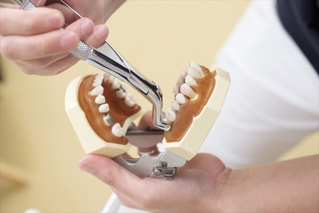 大人特有の歯の悩みや抜歯に関する疑問への対応
